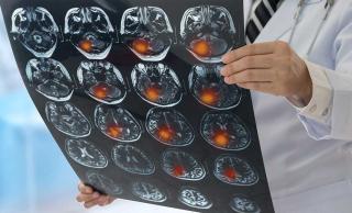 Brain imaging