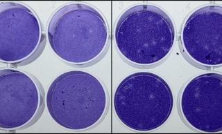 Cells treated with the compound