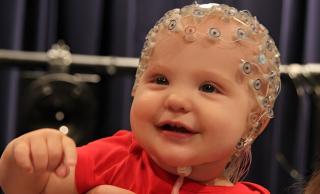 Electroencephalography